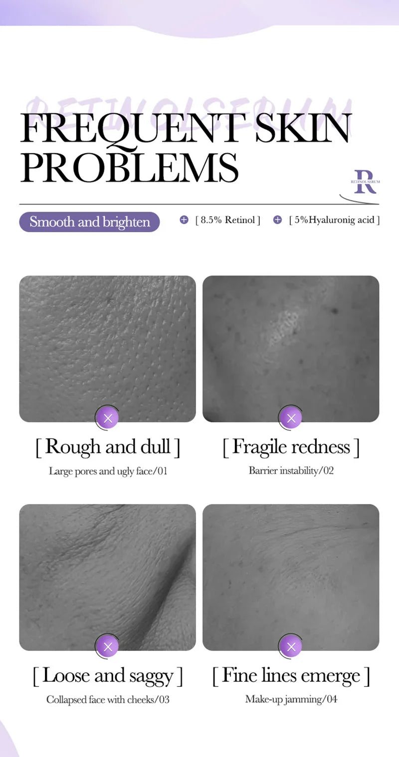 BIOAOUA Retinol Essence Anti-wrinkle Hydrating Moisturizing Nourishing Brightening Skin Color Face Serum Skin Care Products