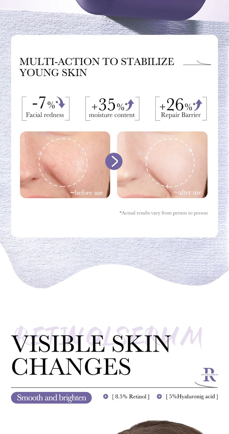 BIOAOUA Retinol Essence Anti-wrinkle Hydrating Moisturizing Nourishing Brightening Skin Color Face Serum Skin Care Products