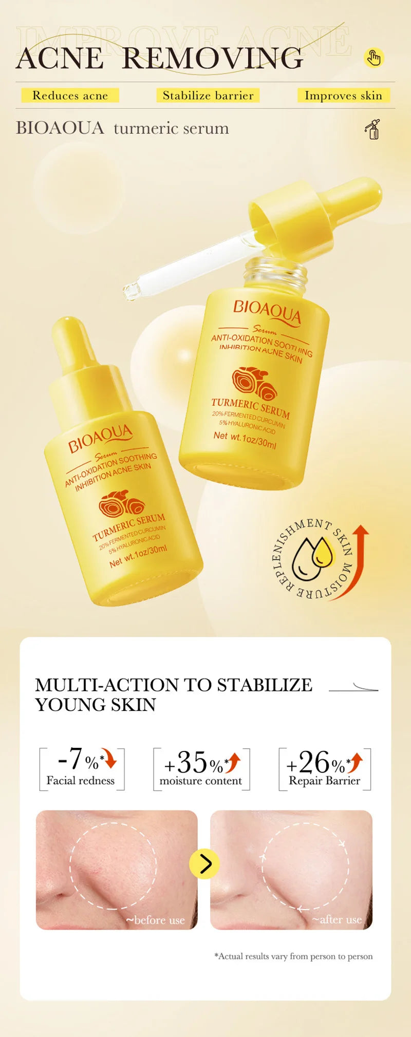 BIOAOUA Retinol Essence Anti-wrinkle Hydrating Moisturizing Nourishing Brightening Skin Color Face Serum Skin Care Products